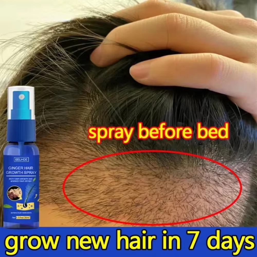Epidermal Growth Factor - Schnelles Ingwer-Haarwuchsspray für Wurzelwachstum, Anti-Haarausfall, Haarwuchs-Serum,