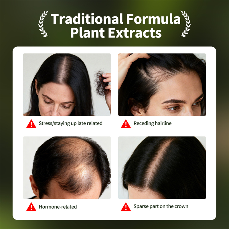 Natürliches Haarwachstumsset U – Epidermal Growth Factor Bewertung und Preis