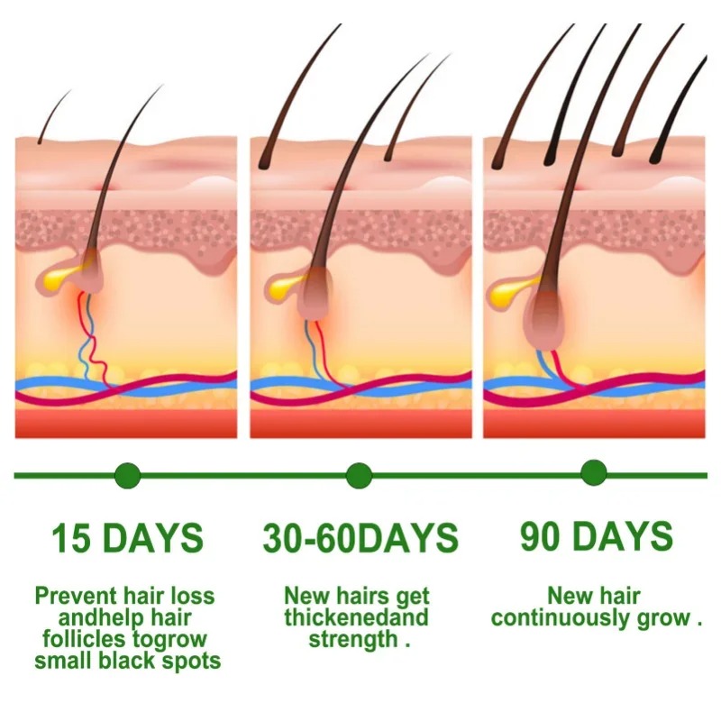 Haarwachstumsserum, schnell wa – Epidermal Growth Factor Bewertung und Preis