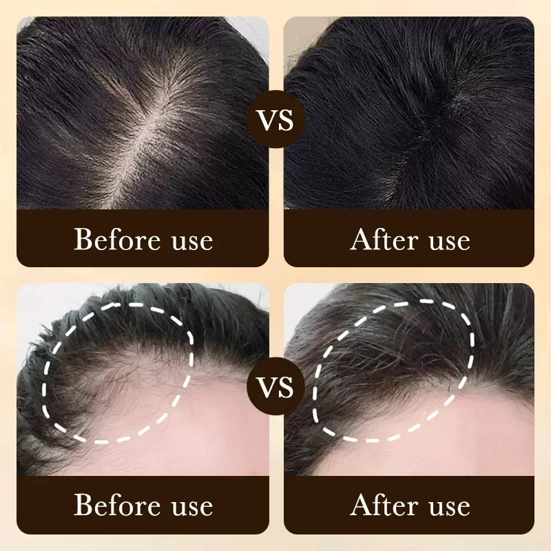 Biotin Schnelles Haarwuchsöl P – Epidermal Growth Factor Bewertung und Preis