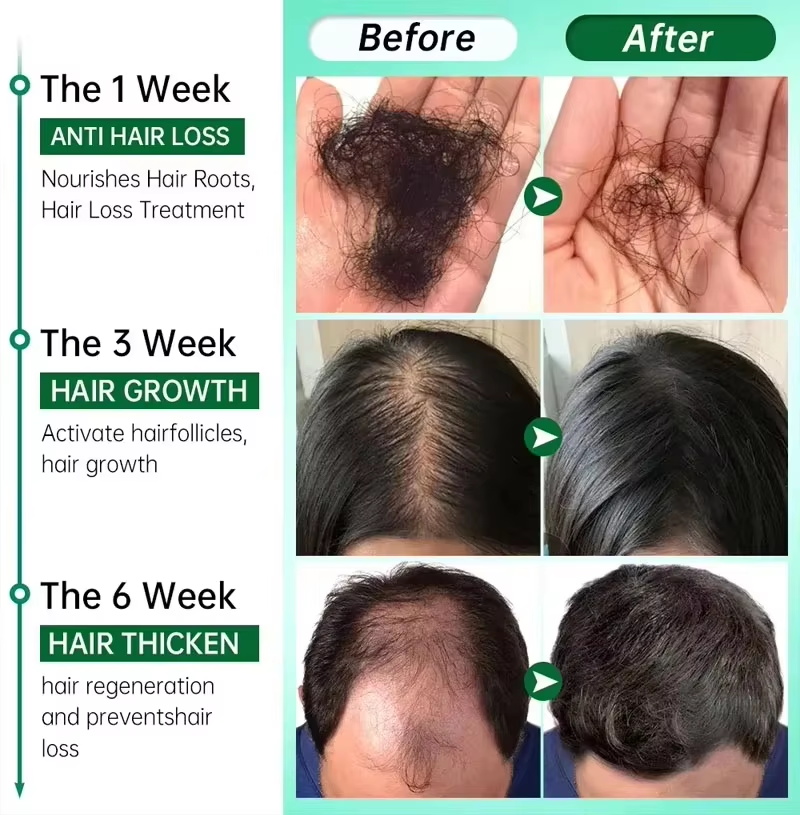 Haarwuchsserum, 7 Tage schnell – Epidermal Growth Factor Bewertung und Preis