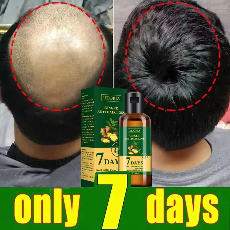 Haarwuchsserum, 7 Tage schnell – Epidermal Growth Factor Bewertung und Preis