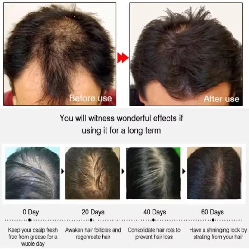 Haarwuchsserum, 7 Tage schnell – Epidermal Growth Factor Bewertung und Preis