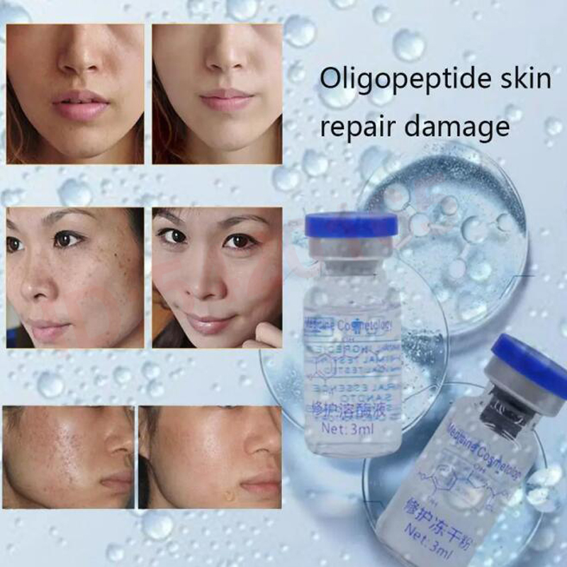 oligopeptid Gefriergetrocknete – Epidermal Growth Factor Bewertung und Preis