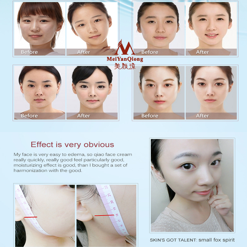 Gesicht Heben Shaping Hautpfle – Luxury Skincare China Bewertung und Preis